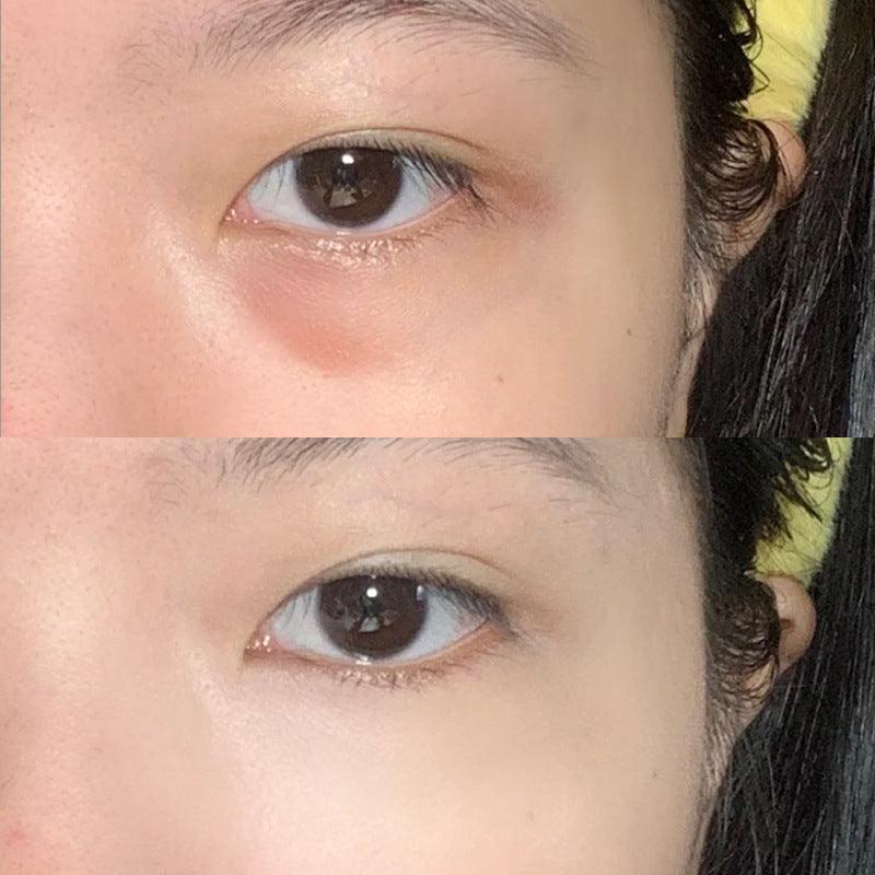SPENNY Concealer Palette 5.6g Version 1.0 Conceal Acne Scars Under-eye Bags Dark Circles Tear Troughs - Peachy Glam